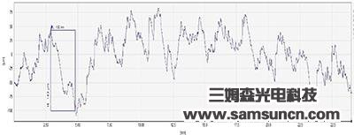 Scratch detection of precision aluminum parts_hjhb861.com