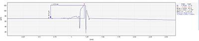 Convex hull detection of laser welding slag_hjhb861.com